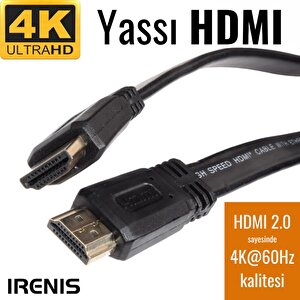 Irenis Hdmi Kablo - Yassı 4k Hdmi Kablosu (4k 60hz, Hdmi 2.0) 1 m
