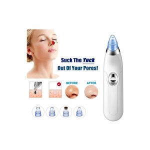 Profesyonel Vakumlu Yüz Temizleyici Siyah Nokta Akne Peeling