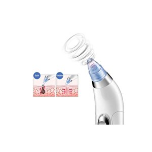 Profesyonel Vakumlu Yüz Temizleyici Siyah Nokta Akne Peeling
