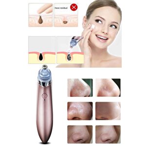4başlıklı Şarjlı Yüz Gözenek Temizleyici Siyah Nokta Çıkarıcı Akne Sökücü Dermabrazyon