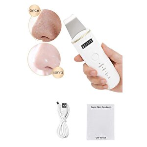 Ultrasonic Scubber Siyah Nokta Akne Gidereci Yüz Spatulası Ölü Deri Temizleme