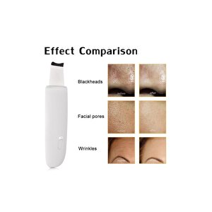 Ultrasonic Siyah Nokta Akne Sivilce Giderici Scrubber Spatula Şarjlı Cilt Temizleyici