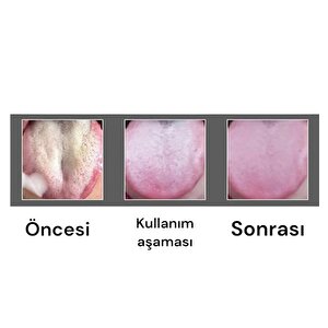 Hijyenik,paslanmaz Çelik Dil Temizleme Aparatı Hijyenik Kutulu