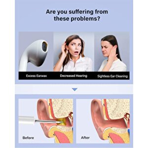 Bebird T5 3mp Kamera 3.5mm Lens Şarjli Wifi Görüntülü Kulak Temi̇zleyi̇ci̇ Beyaz Renk