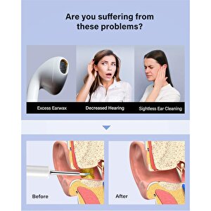 Bebird T5 3mp Kamera 3.5mm Lens Şarjli Wifi Görüntülü Kulak Temi̇zleyi̇ci̇ Beyaz Renk