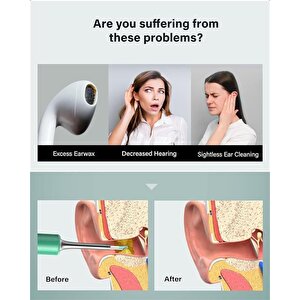 Bebird T5 3mp Kamera 3.5mm Lens Şarjli Wifi Görüntülü Kulak Temi̇zleyi̇ci̇ Yeşi̇l Renk