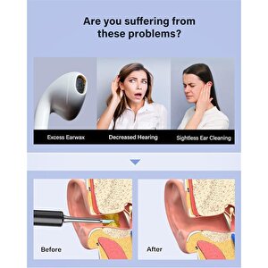 Bebird T5 3mp Kamera 3.5mm Lens Şarjli Wifi Görüntülü Kulak Temi̇zleyi̇ci̇ Si̇yah Renk