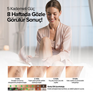 Bester Ipl7100 Buz Lazer Acısız Ipl Lazer Epilasyon Aleti – 5 Kademe, 1.000.000 Atım